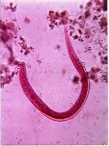 Parasite course