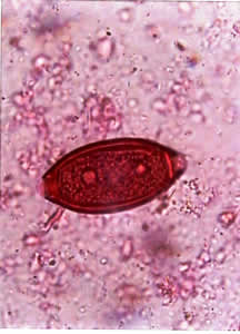 Trichuris trichua