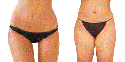 This Is What The Gap Between Your Thighs Says About Your